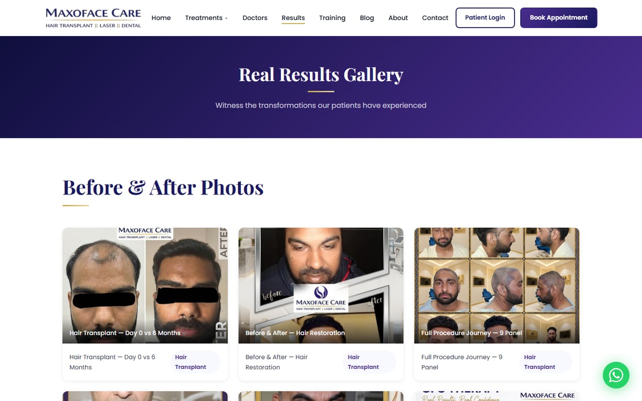 Maxo Face Care before and after results gallery